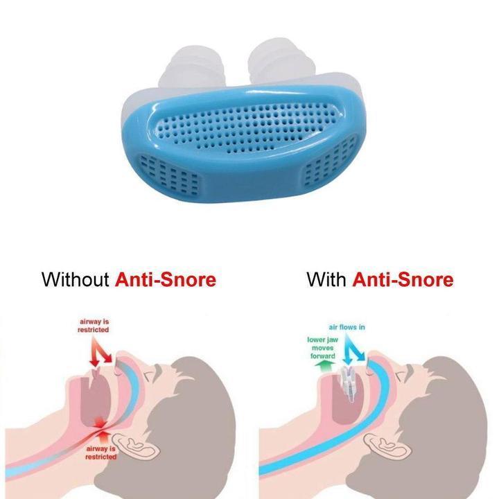 Anti-Snoring Device